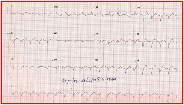 ECGquiz