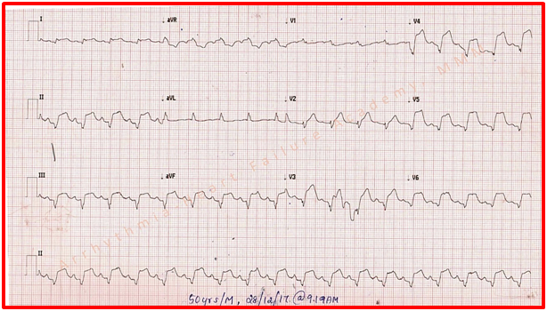 ECGquiz