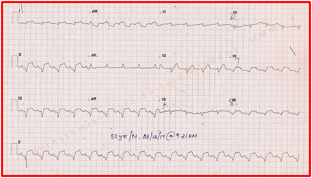 ECGquiz
