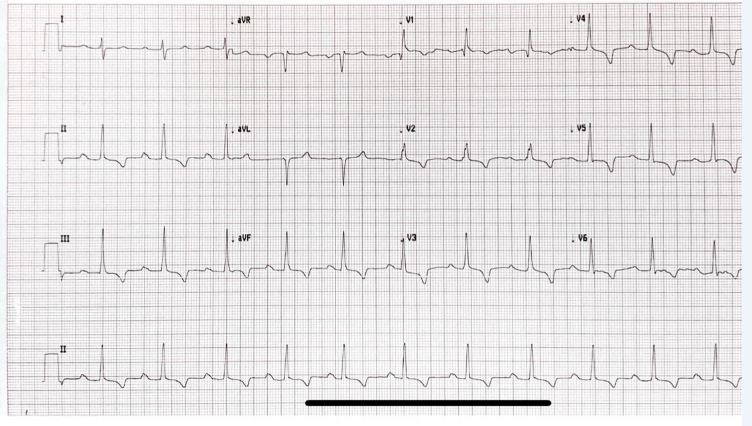 ECGquiz
