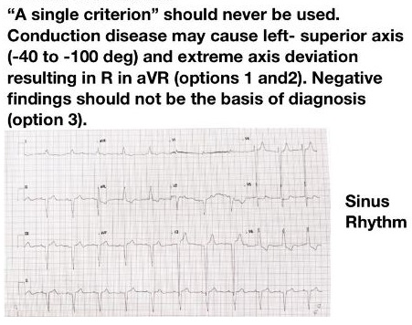 ECGquiz